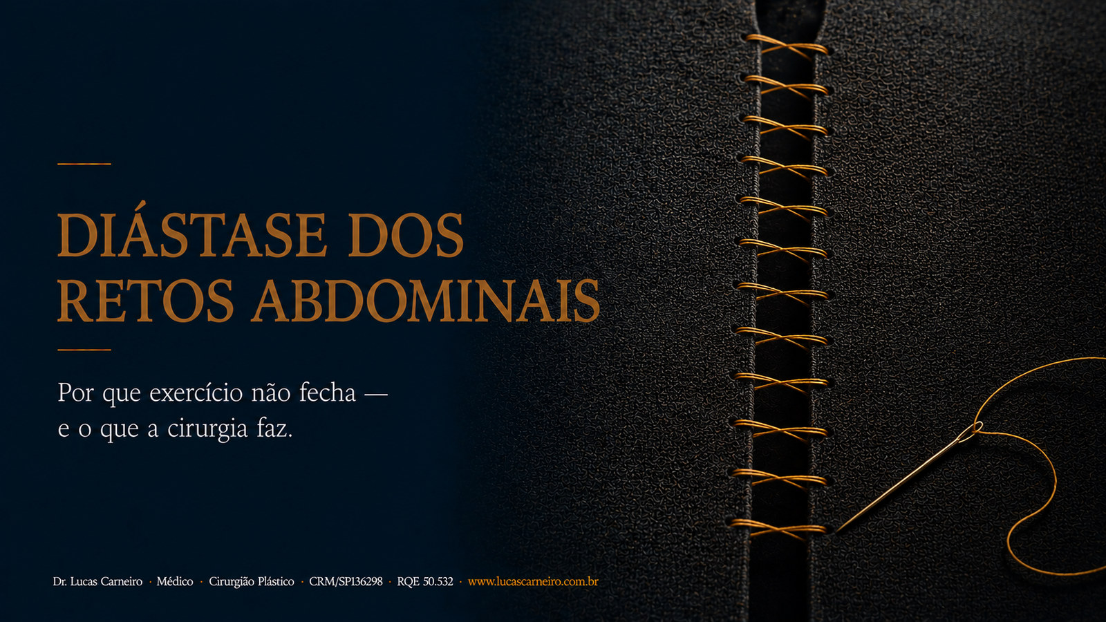 Capa do artigo: Abdominoplastia e Diástase: O Que é, Como Identificar e O Que a Cirurgia Resolve